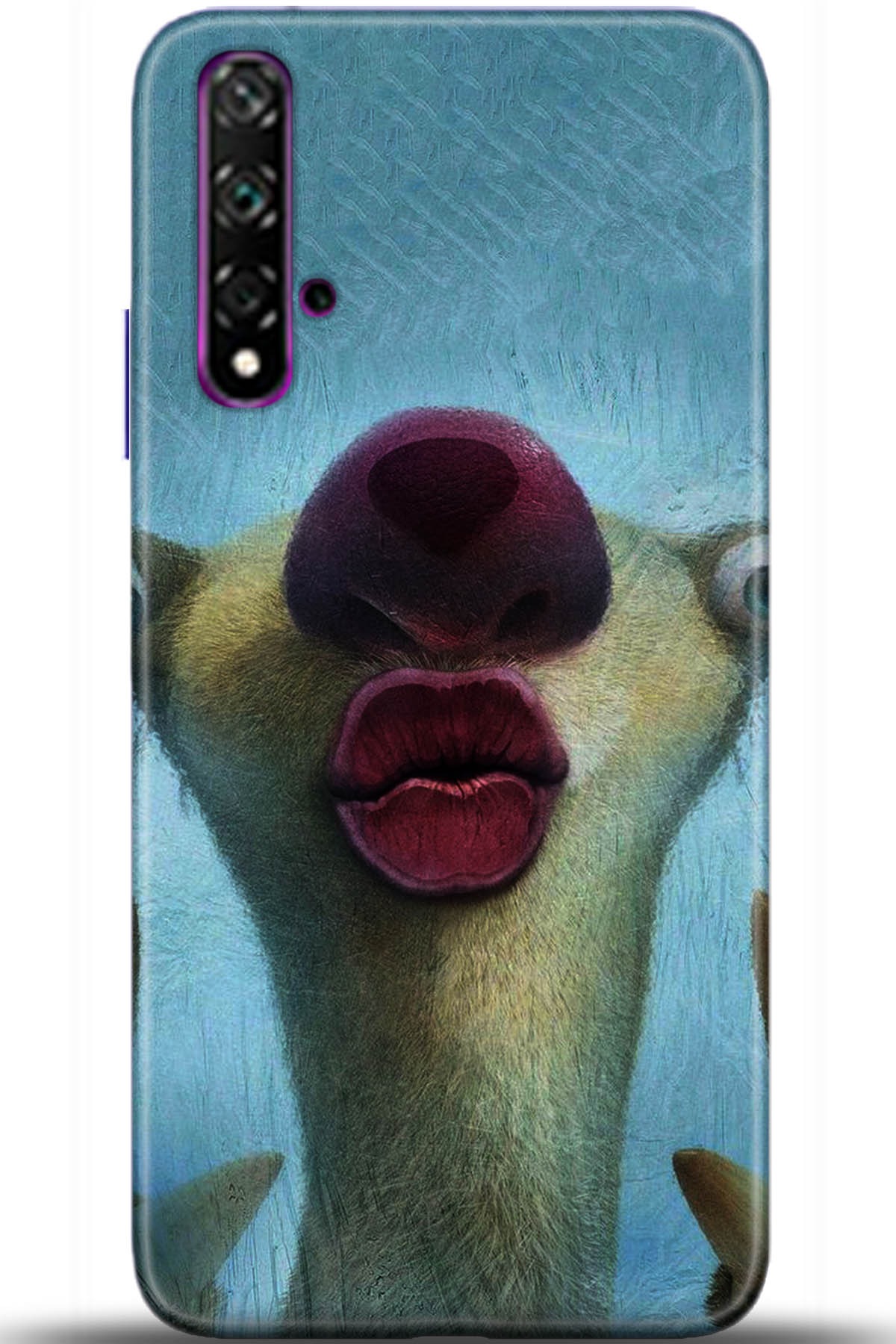 Honor 20 Kılıf HD Baskılı Kılıf - Followed Institution 5372