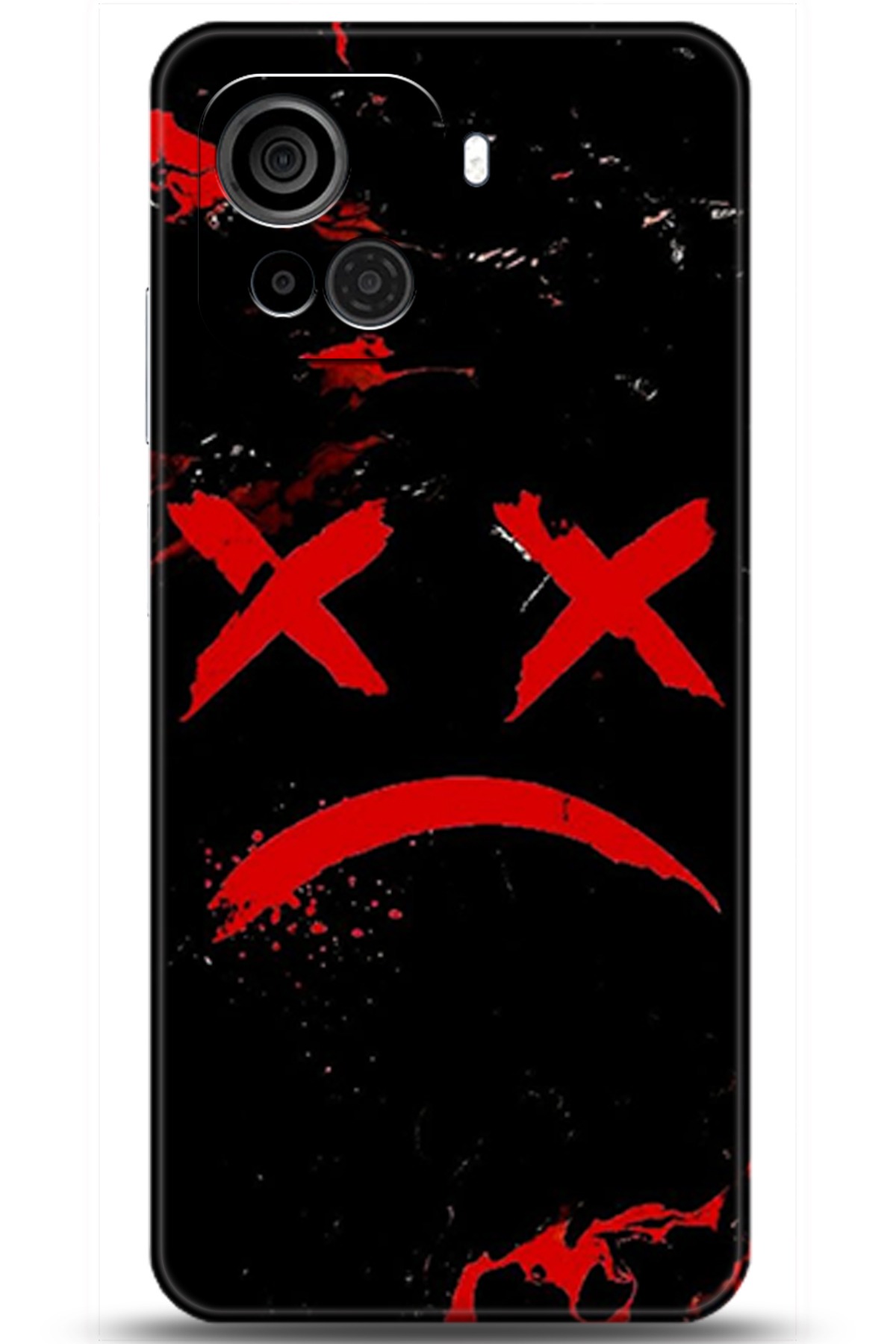 Casper Via F30 Uyumlu Kılıf HD Baskılı Kılıf - Followed Institution 5139