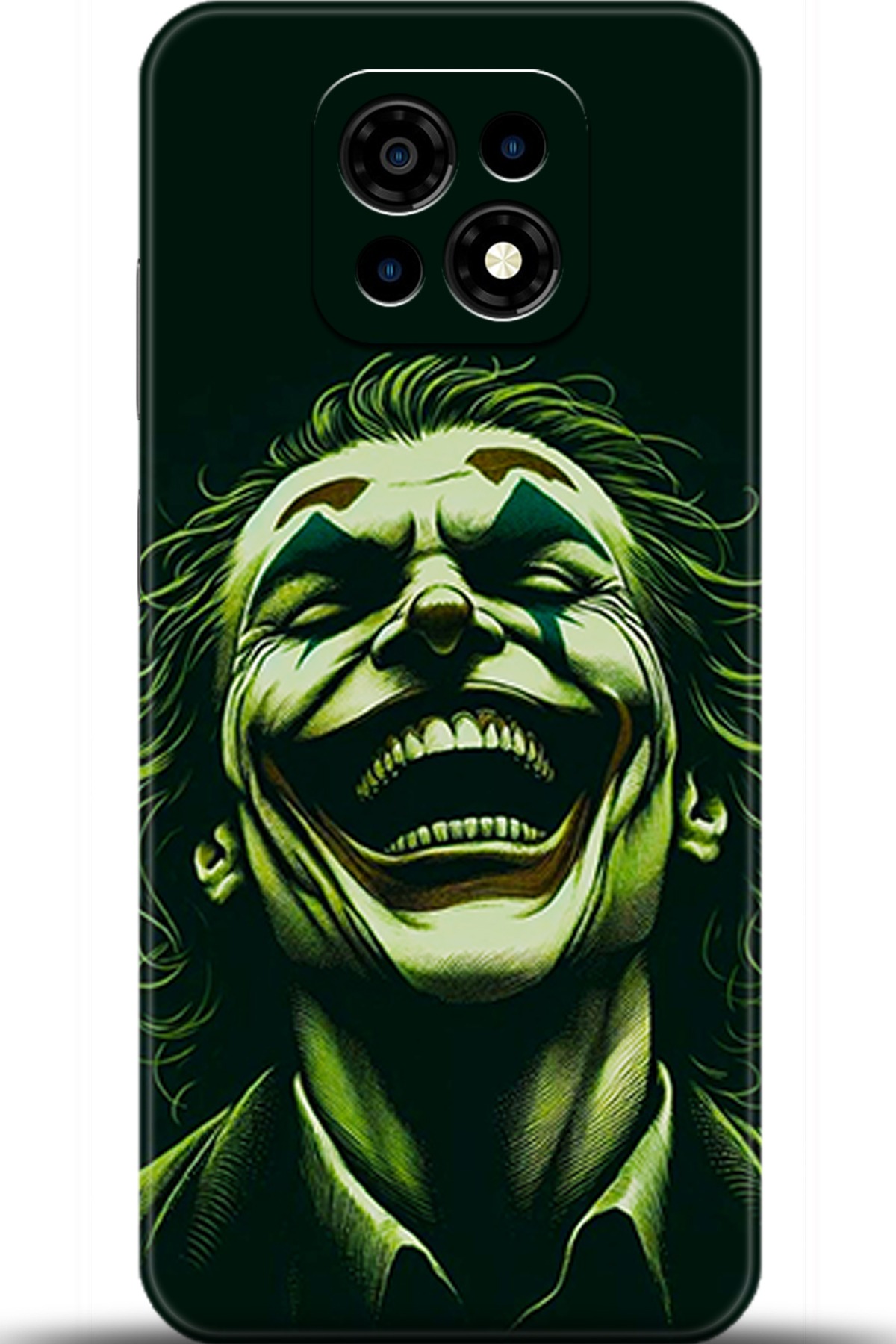 Casper Via M30 Uyumlu Kılıf HD Baskılı Kılıf - Followed Institution 5415