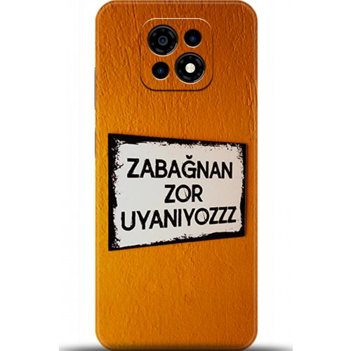 Uyumlu Kılıf HD Baskılı Kılıf - Followed Institution 5590