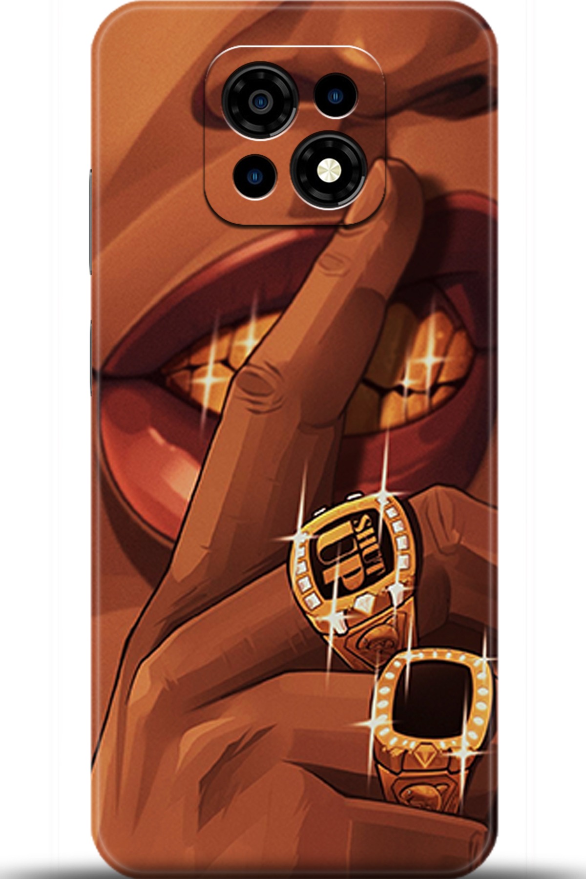 Casper Via M30 Uyumlu Kılıf HD Baskılı Kılıf - Followed Institution 5631