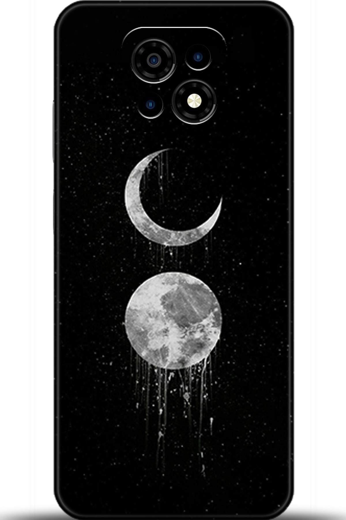 Casper Via M30 Uyumlu Kılıf HD Baskılı Kılıf - Followed Institution 5788