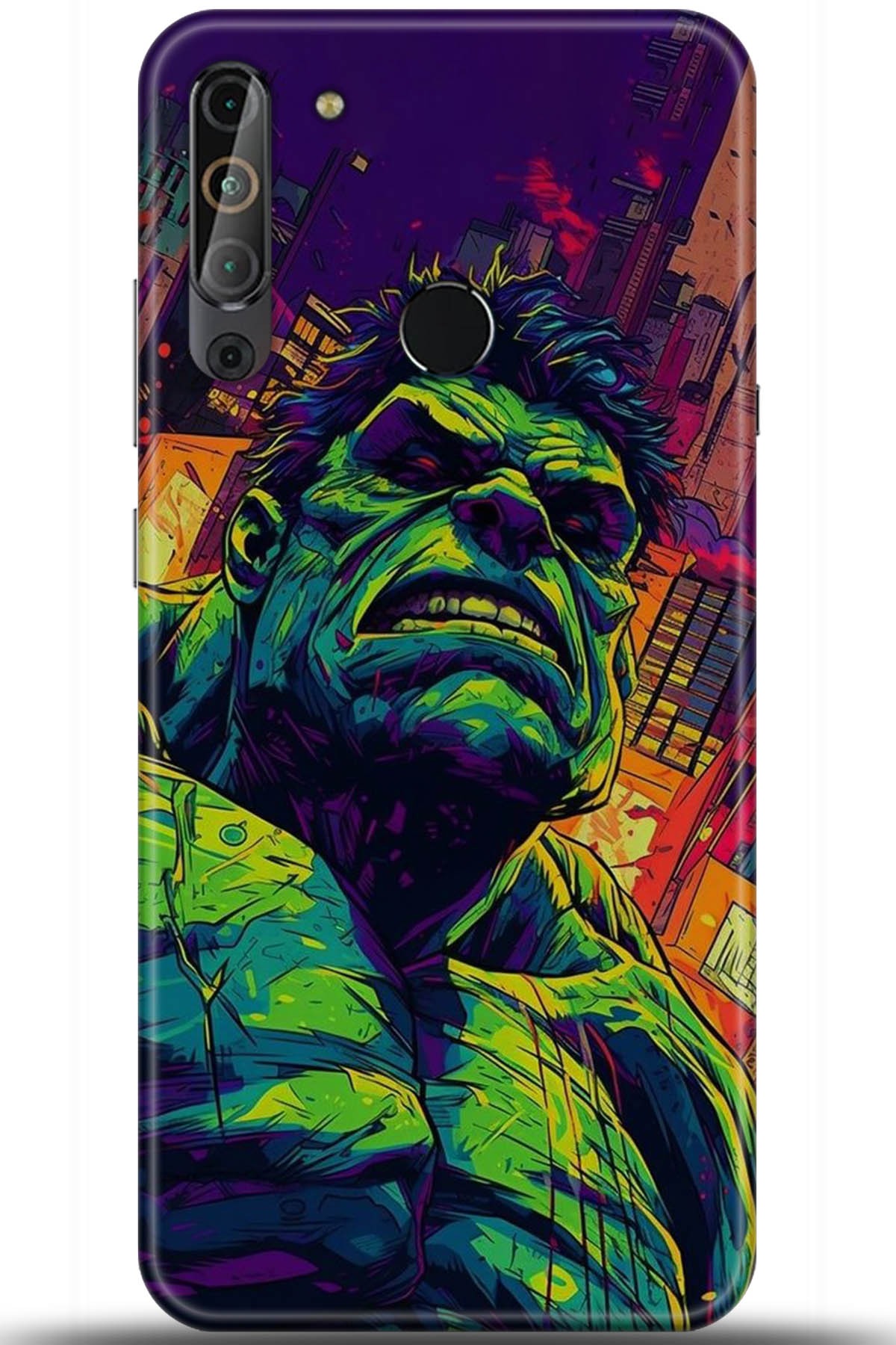 Casper Via X20 Uyumlu Kılıf HD Baskılı Kılıf - Followed Institution 5365