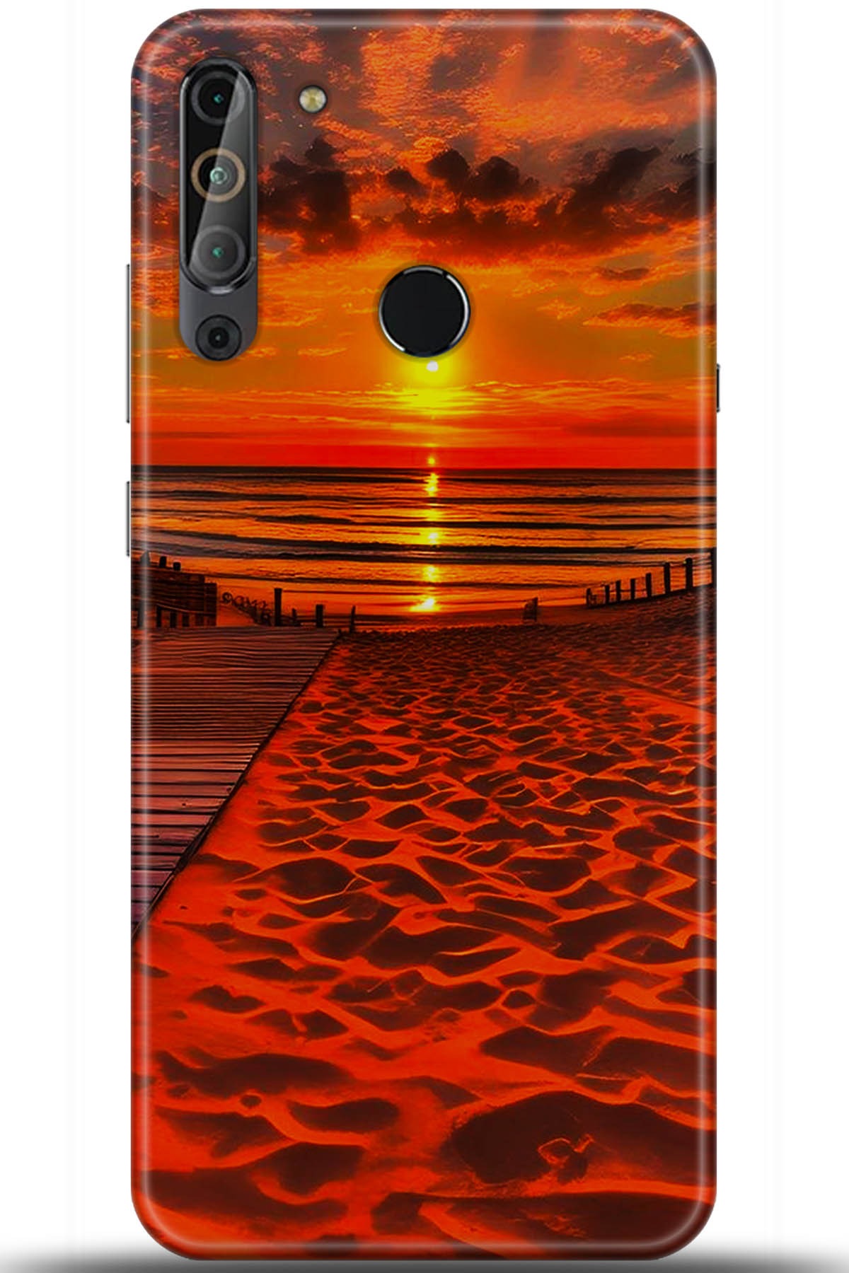 Casper Via X20 Uyumlu Kılıf HD Baskılı Kılıf - Followed Institution 5600