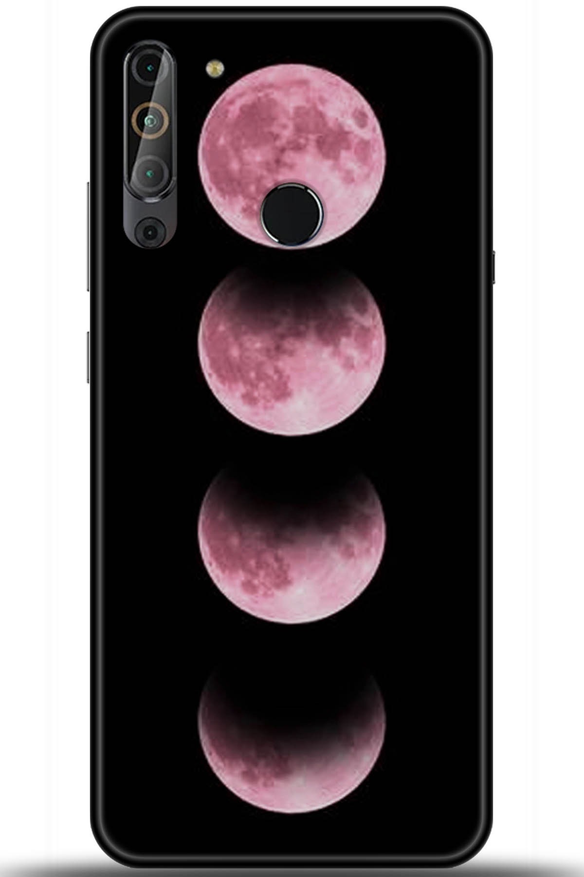 Casper Via X20 Uyumlu Kılıf HD Baskılı Kılıf - Followed Institution 5915