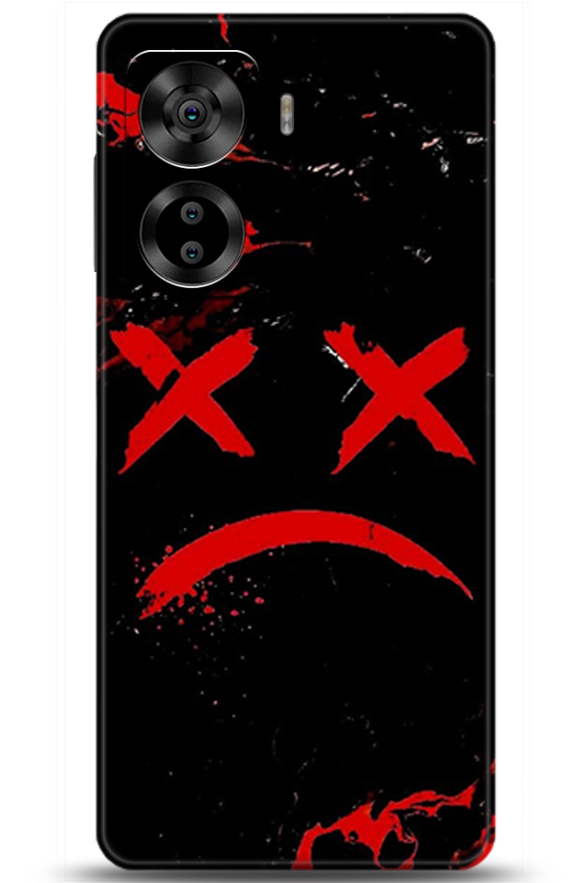 Casper Via X40 Uyumlu Kılıf HD Baskılı Kılıf - Followed Institution 5139