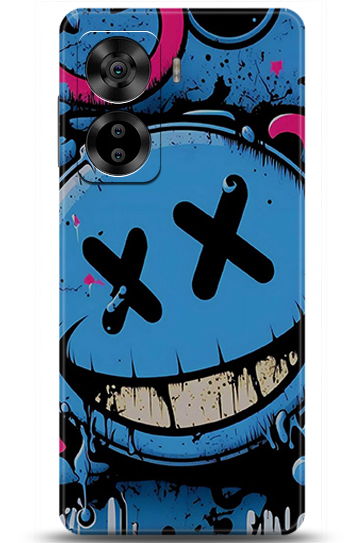 Casper Via X40 Uyumlu Kılıf HD Baskılı Kılıf - Followed Institution 5261