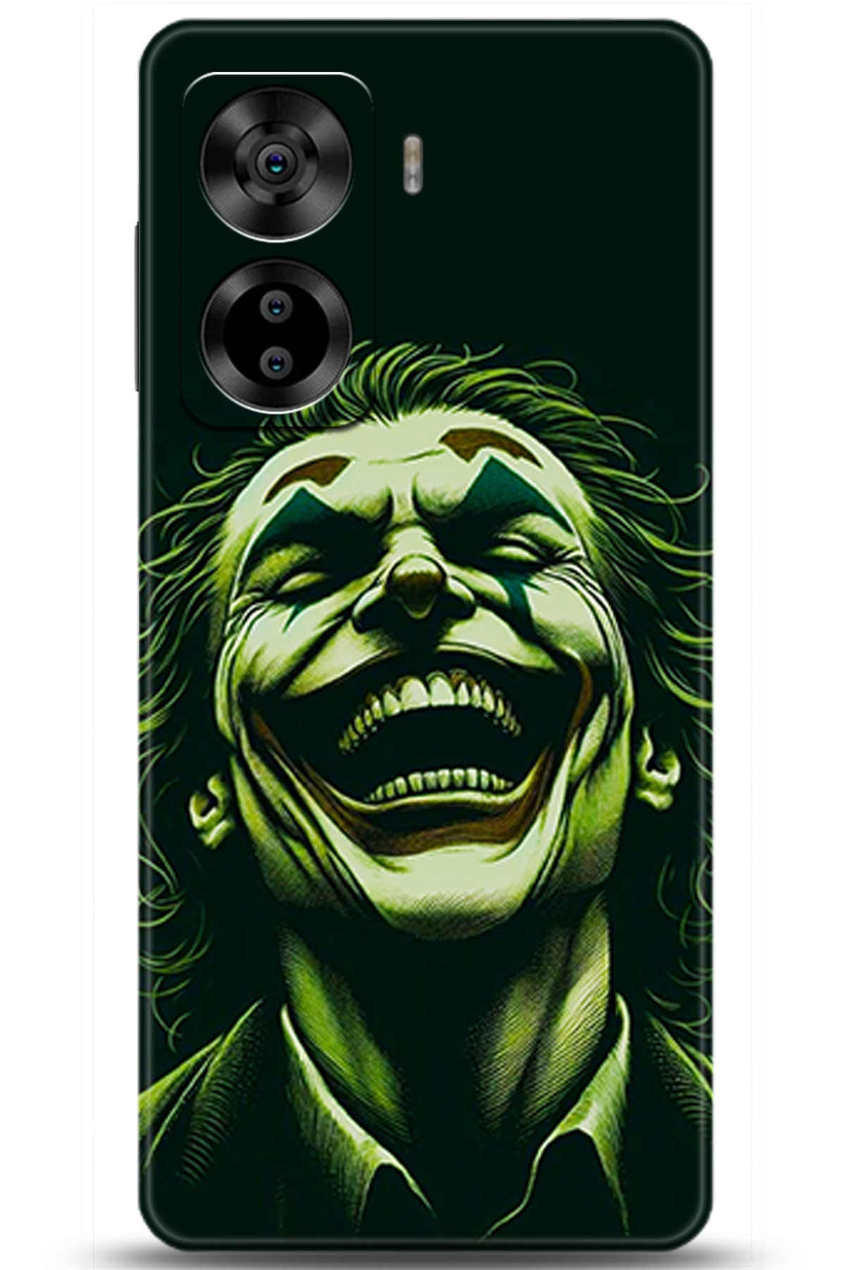 Casper Via X40 Uyumlu Kılıf HD Baskılı Kılıf - Followed Institution 5415