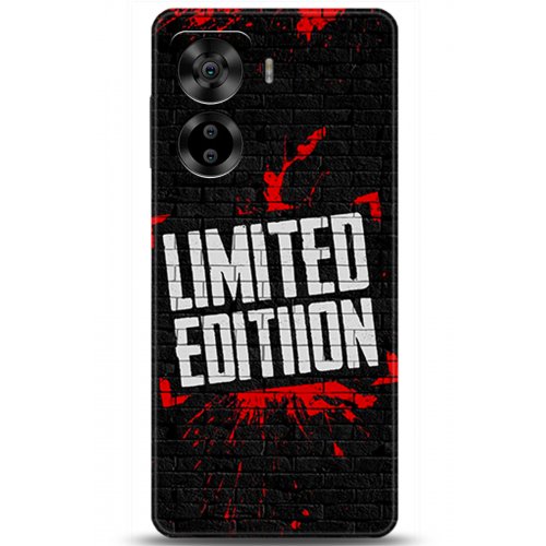 Uyumlu Kılıf HD Baskılı Kılıf - Followed Institution 5454