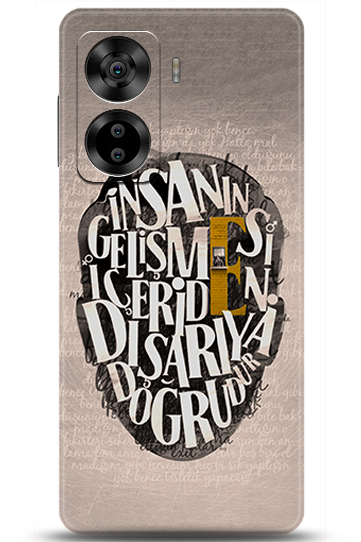 Casper Via X40 Uyumlu Kılıf HD Baskılı Kılıf - Followed Institution 5587