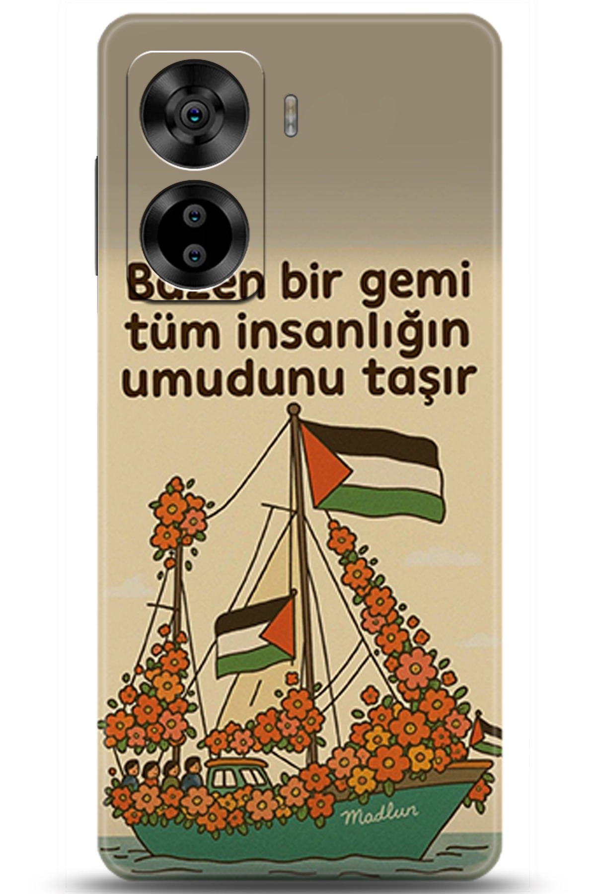 Casper Via X40 Uyumlu Kılıf HD Baskılı Kılıf - Followed Institution 5739