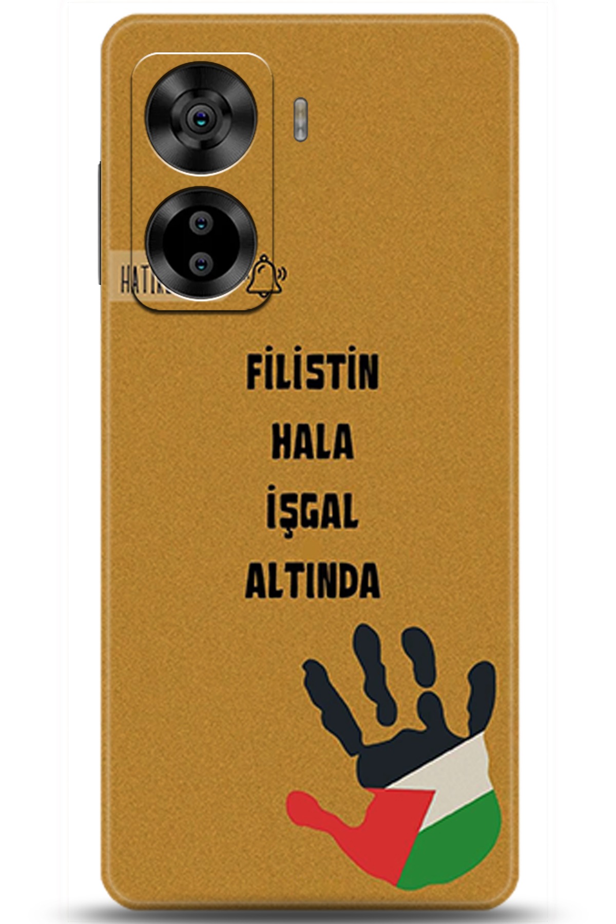 Casper Via X40 Uyumlu Kılıf HD Baskılı Kılıf - Followed Institution 5740