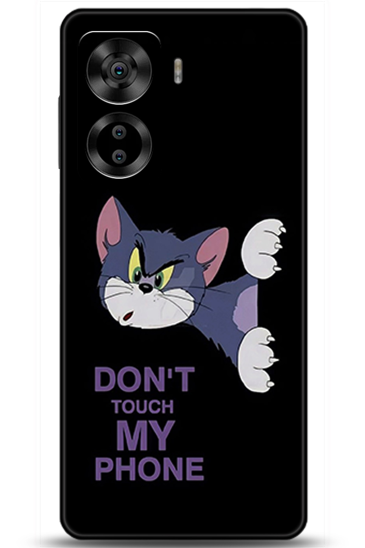 Casper Via X40 Uyumlu Kılıf HD Baskılı Kılıf - Followed Institution 5755