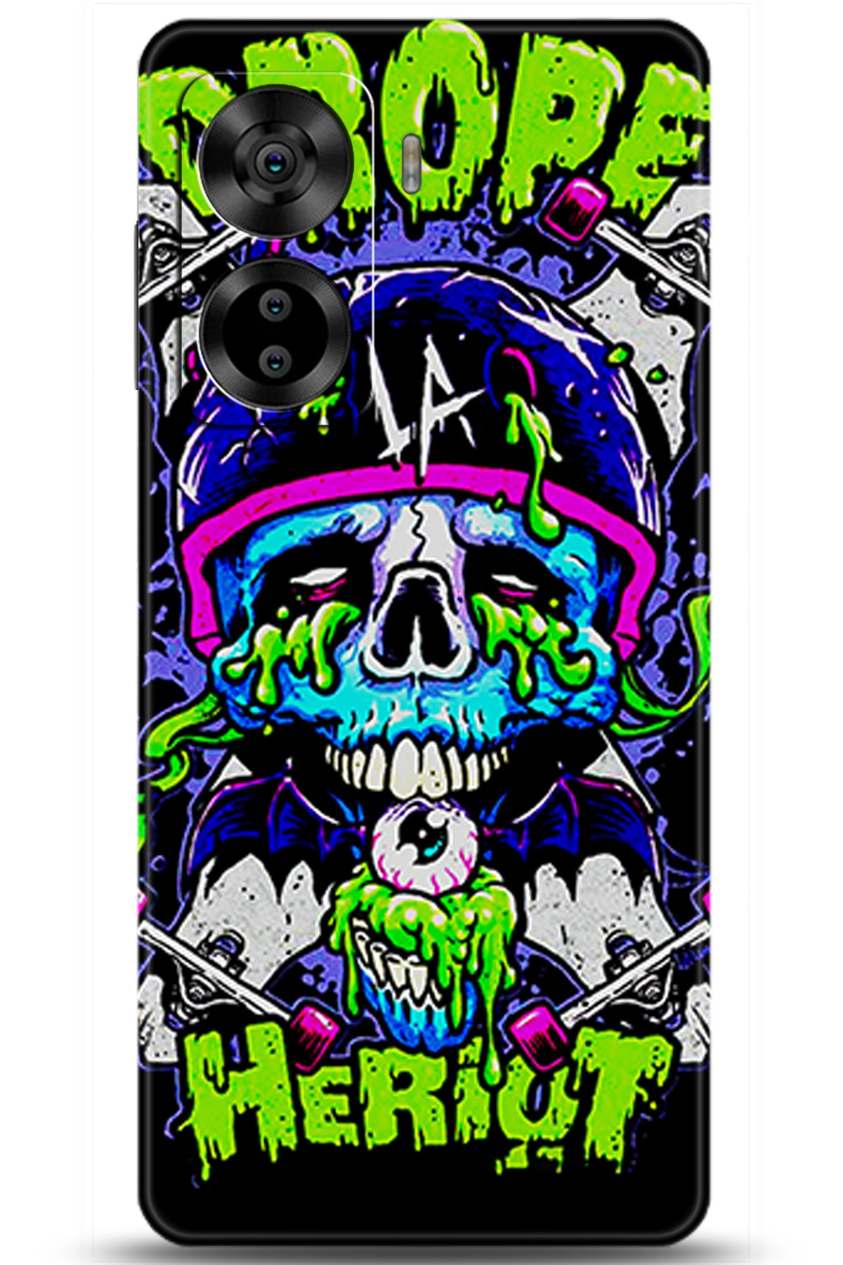 Casper Via X40 Uyumlu Kılıf HD Baskılı Kılıf - Followed Institution 5970