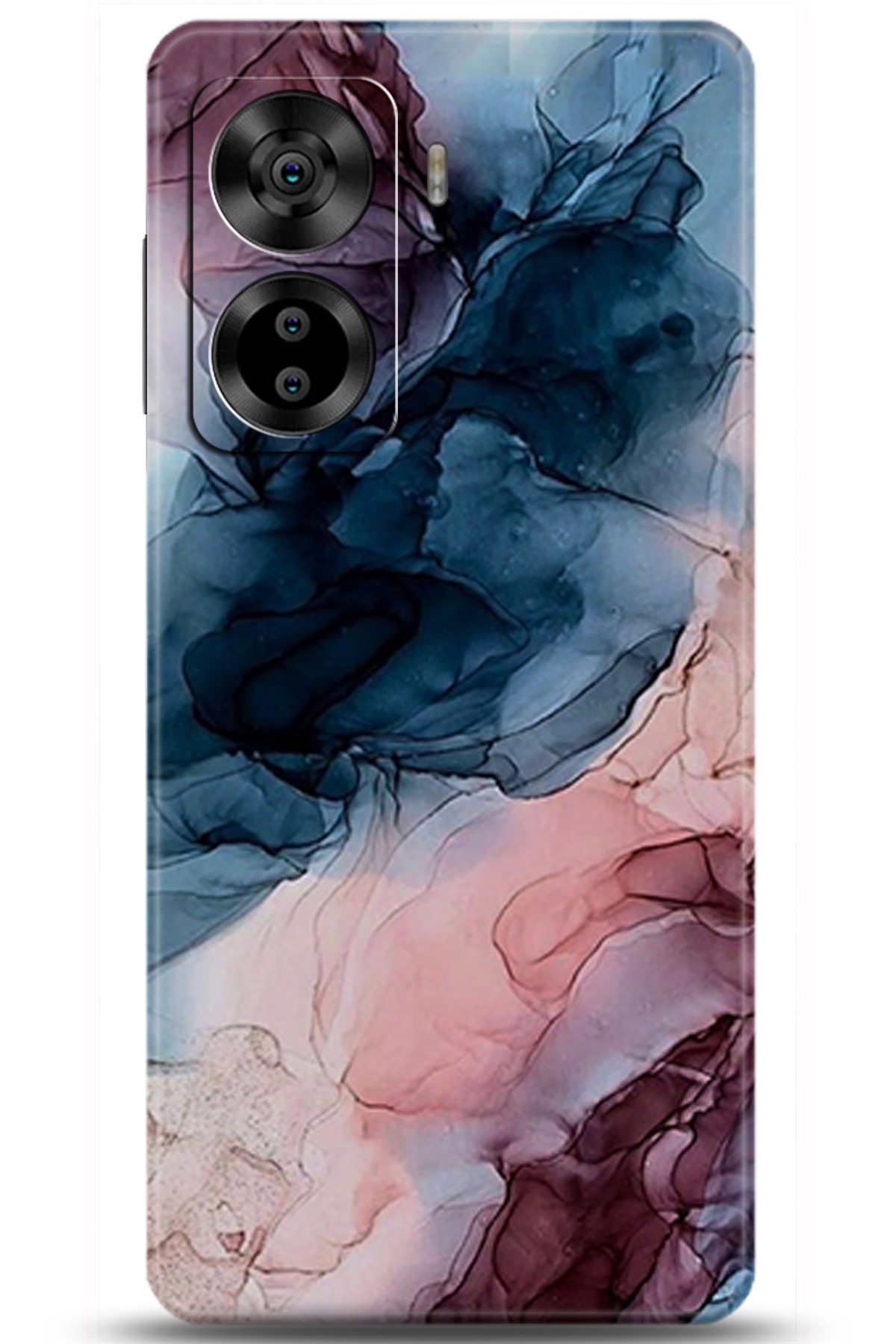 Casper Via X40 Uyumlu Kılıf HD Baskılı Kılıf - Followed Institution 5985