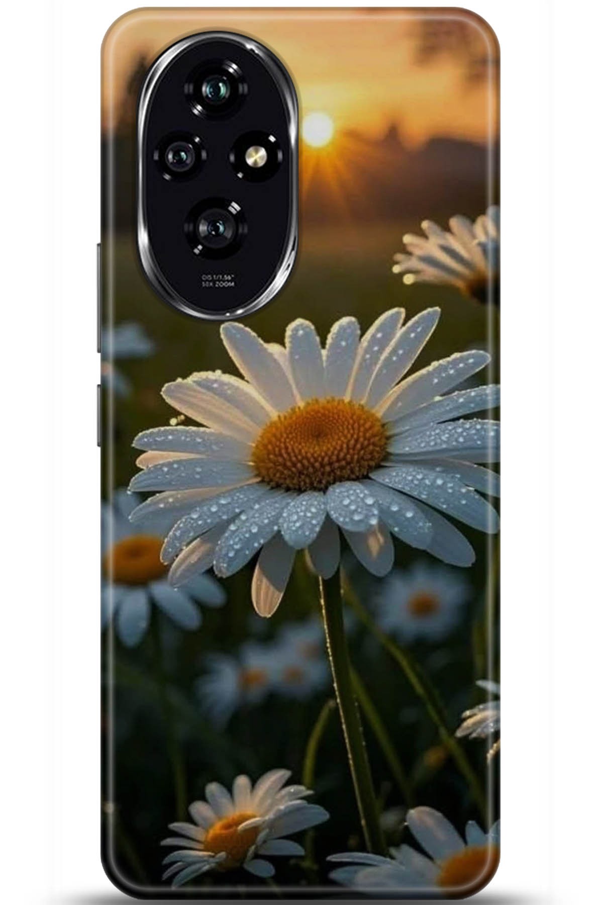 Honor 200 Uyumlu Kılıf HD Baskılı Kılıf - Followed Institution 5747