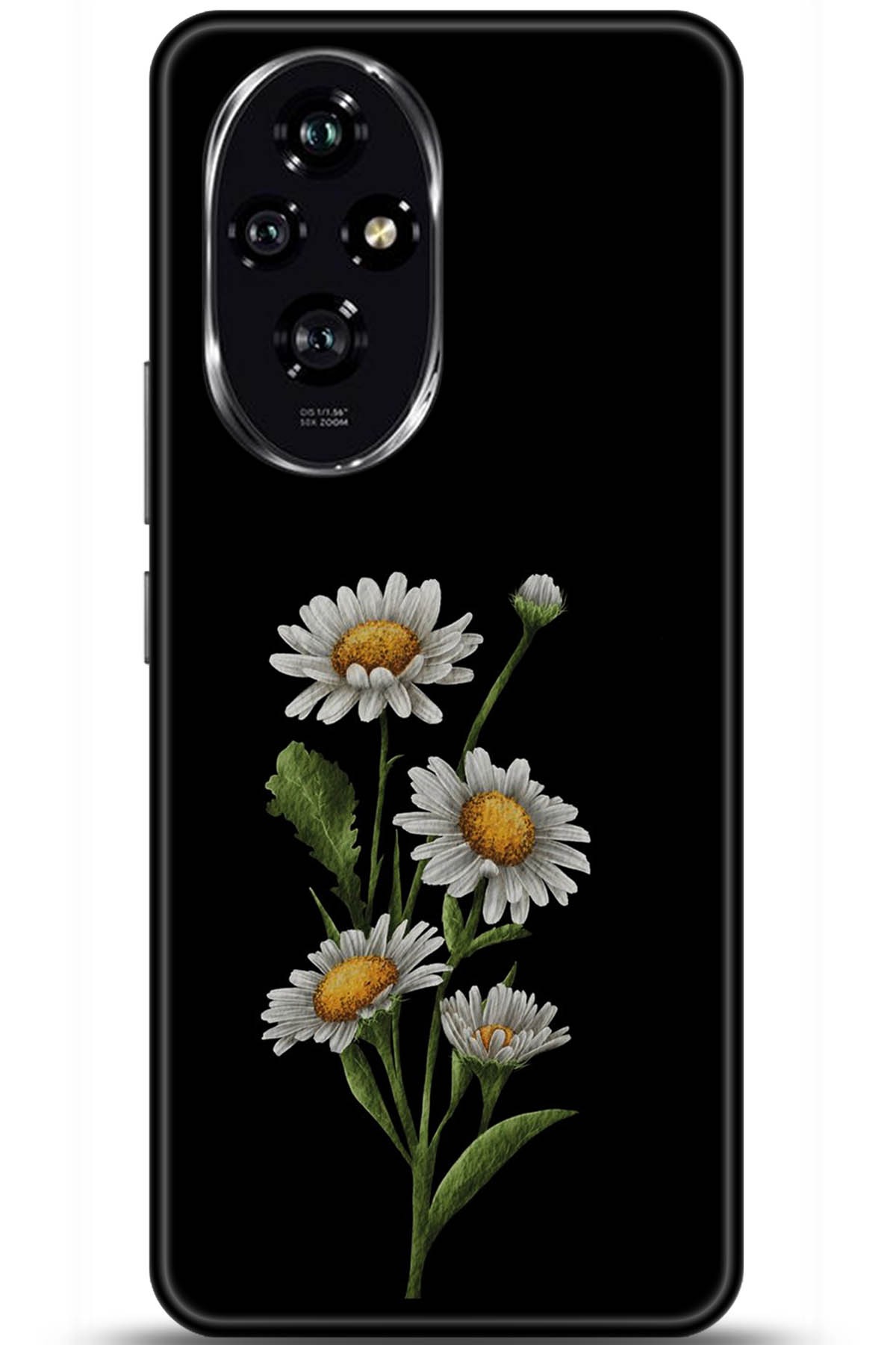 Honor 200 Uyumlu Kılıf HD Baskılı Kılıf - Followed Institution 5756