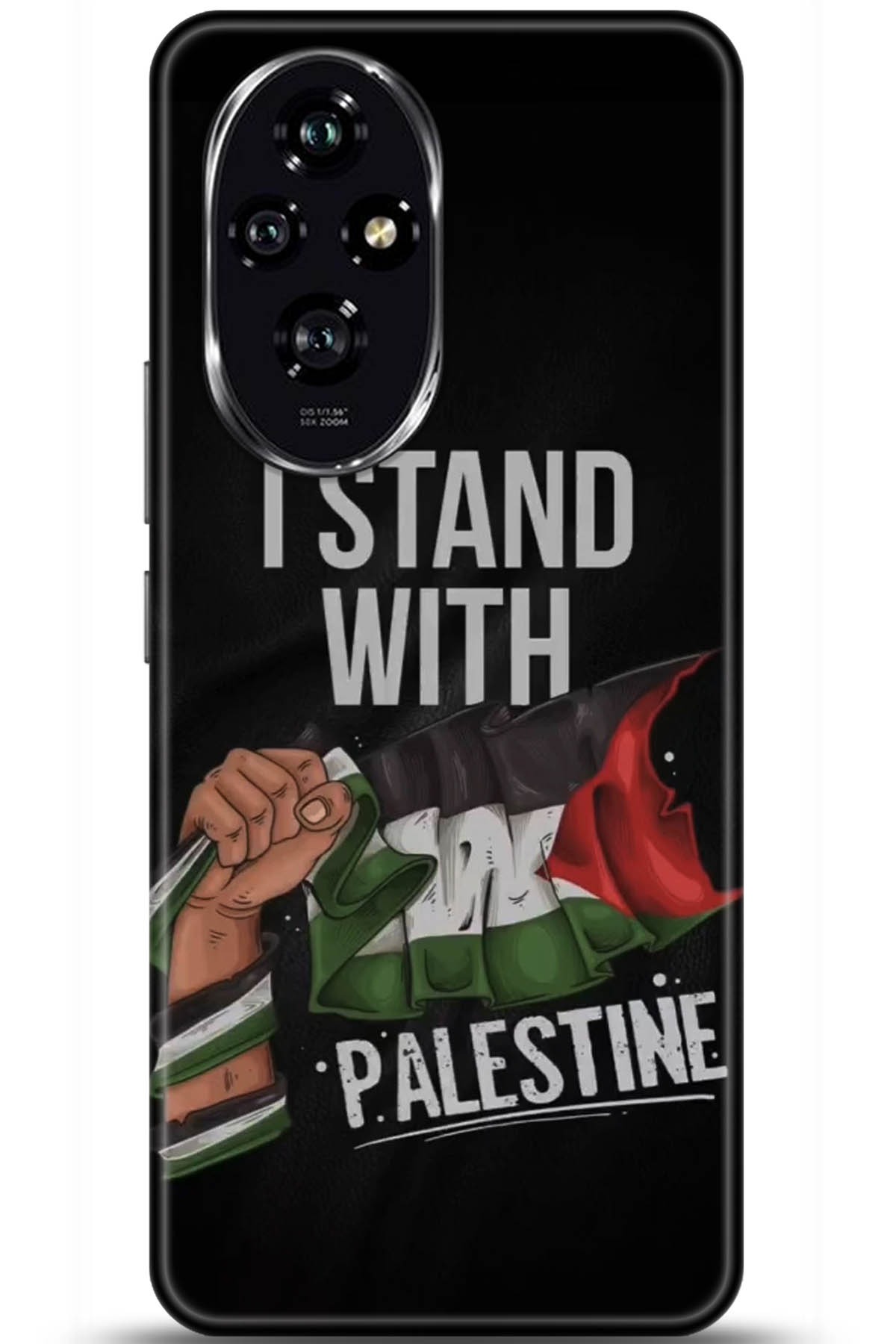 Honor 200 Uyumlu Kılıf HD Baskılı Kılıf - Followed Institution 5804