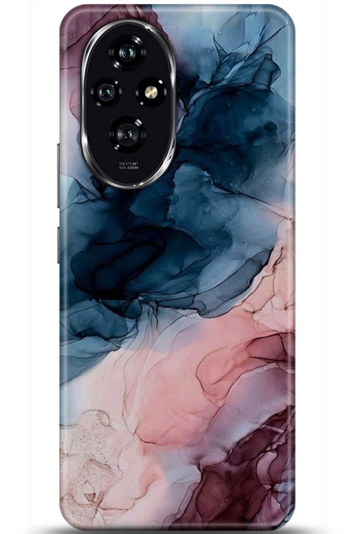 Honor 200 Uyumlu Kılıf HD Baskılı Kılıf - Followed Institution 5985