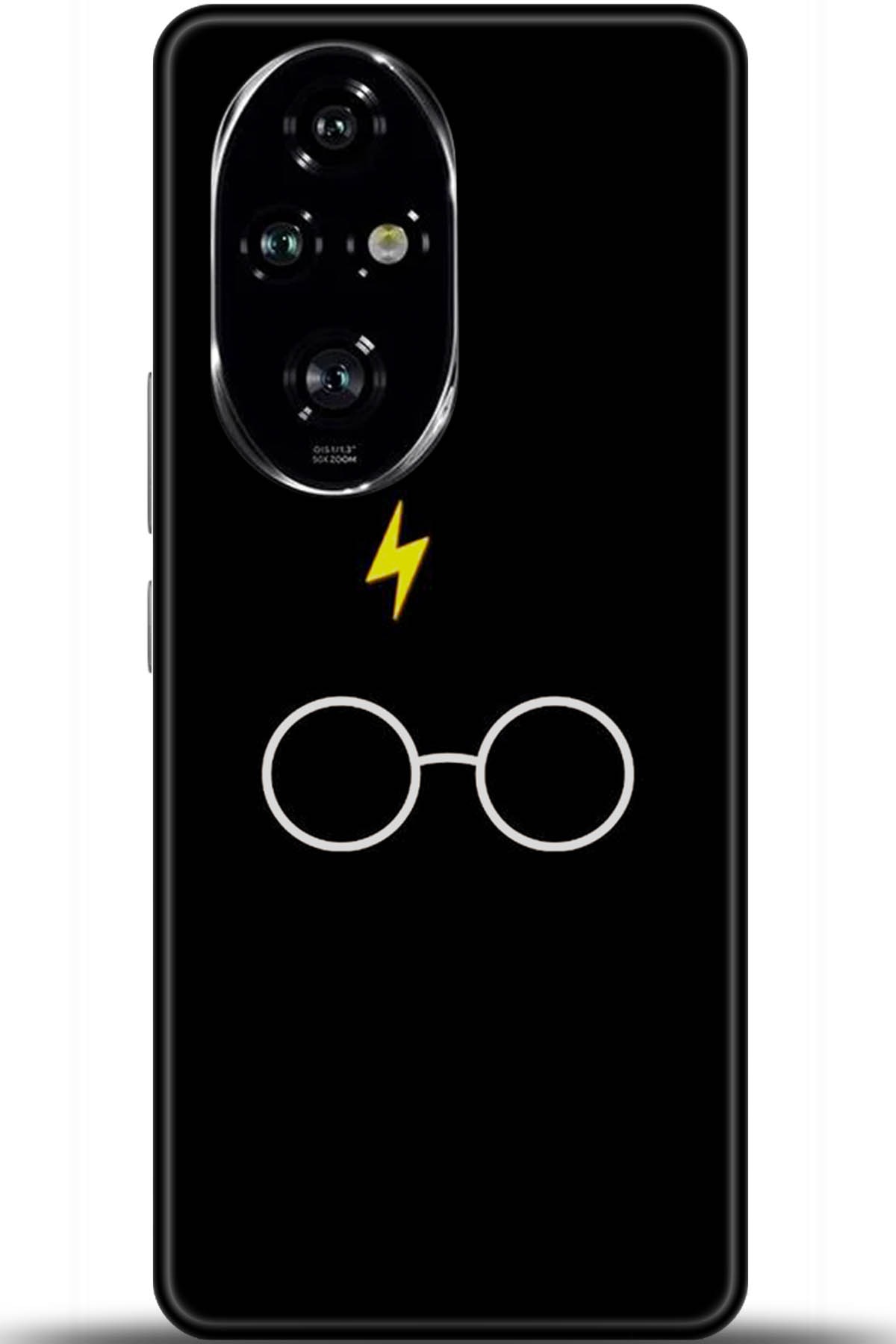 Honor 200 Pro Uyumlu Kılıf HD Baskılı Kılıf - Followed Institution 5550