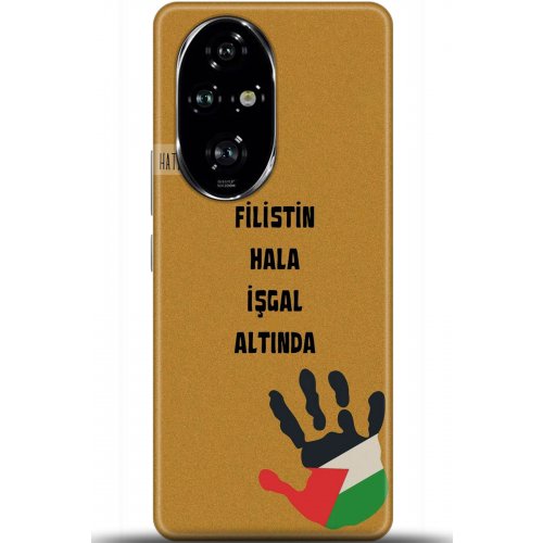 Uyumlu Kılıf HD Baskılı Kılıf - Followed Institution 5740