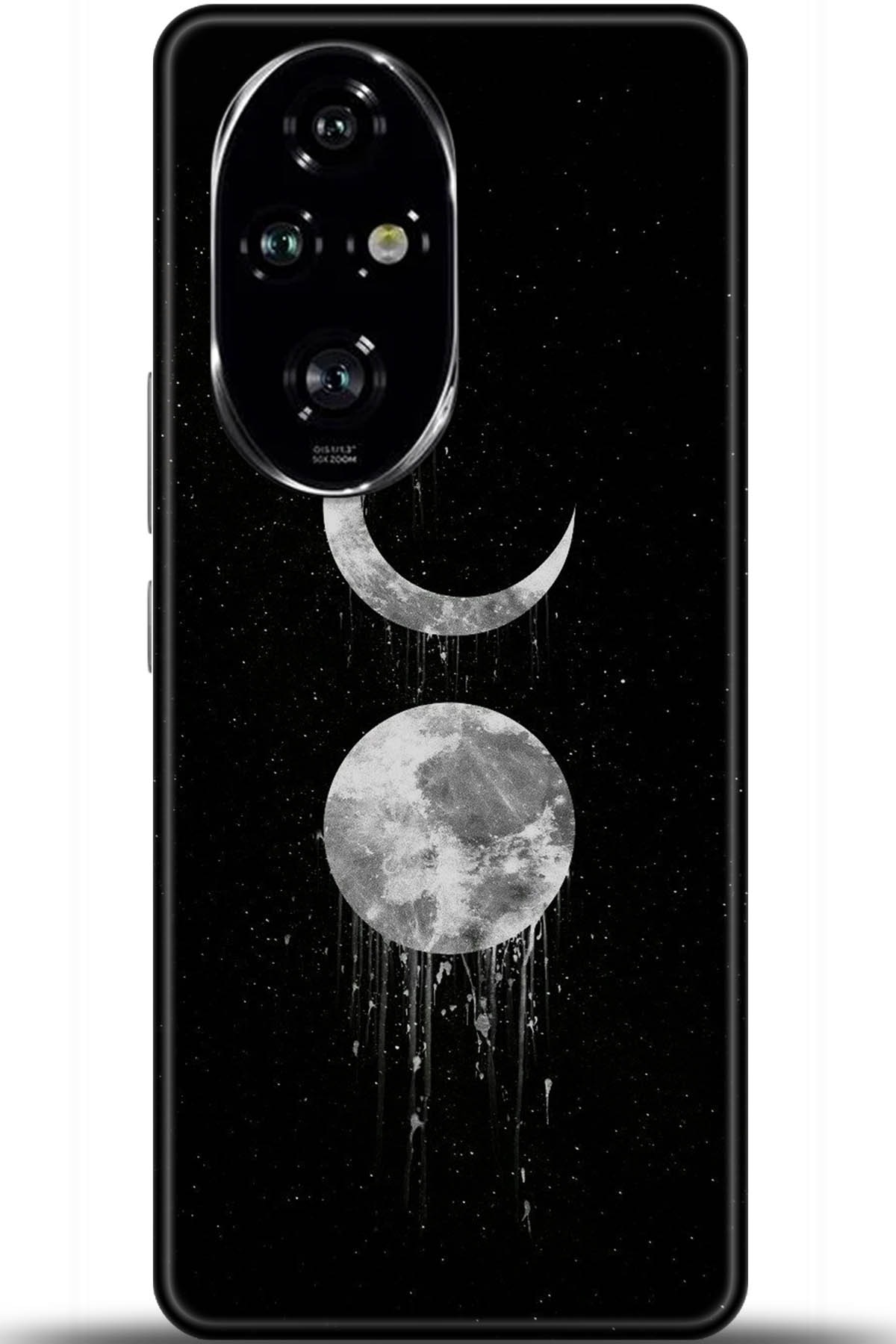 Honor 200 Pro Uyumlu Kılıf HD Baskılı Kılıf - Followed Institution 5788