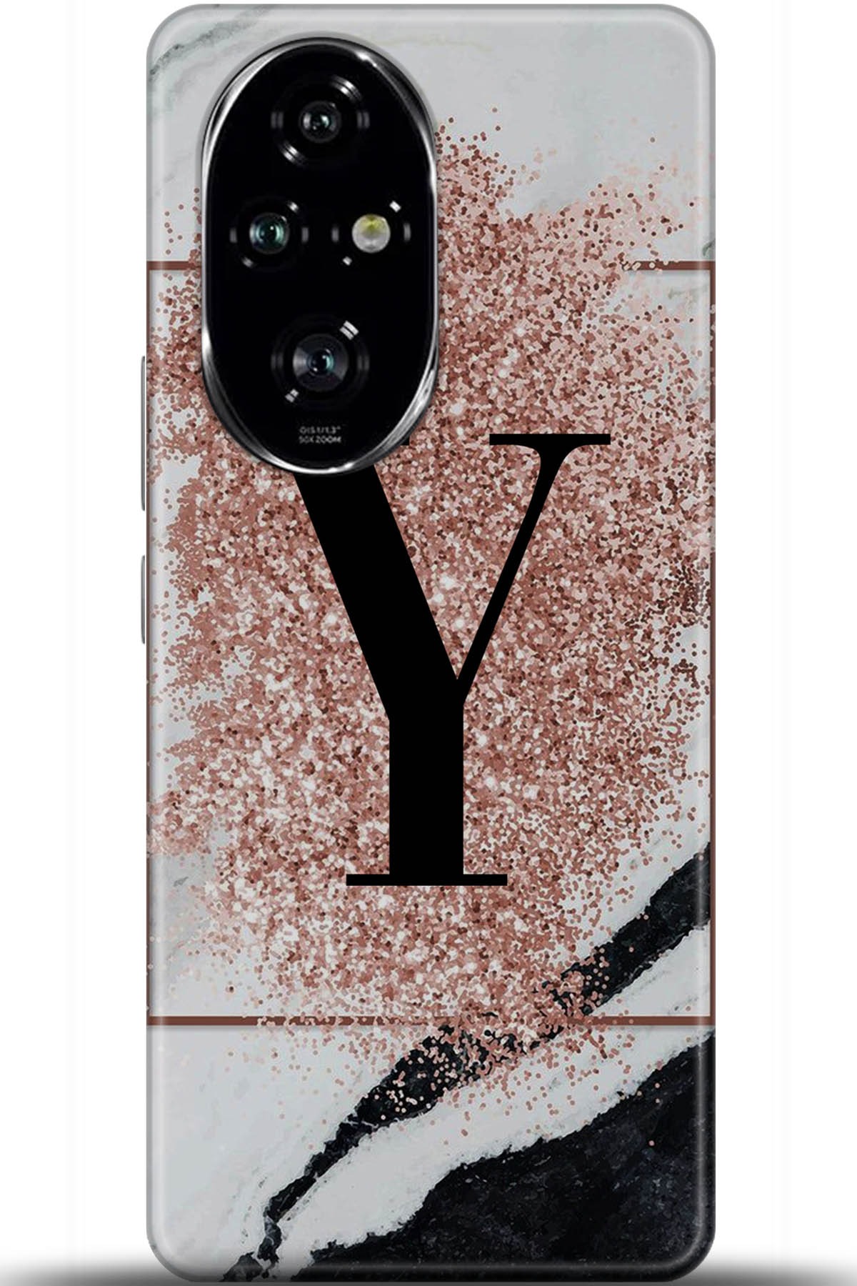 Honor 200 Pro Uyumlu Kılıf HD Baskılı Kılıf - Followed Institution 5994