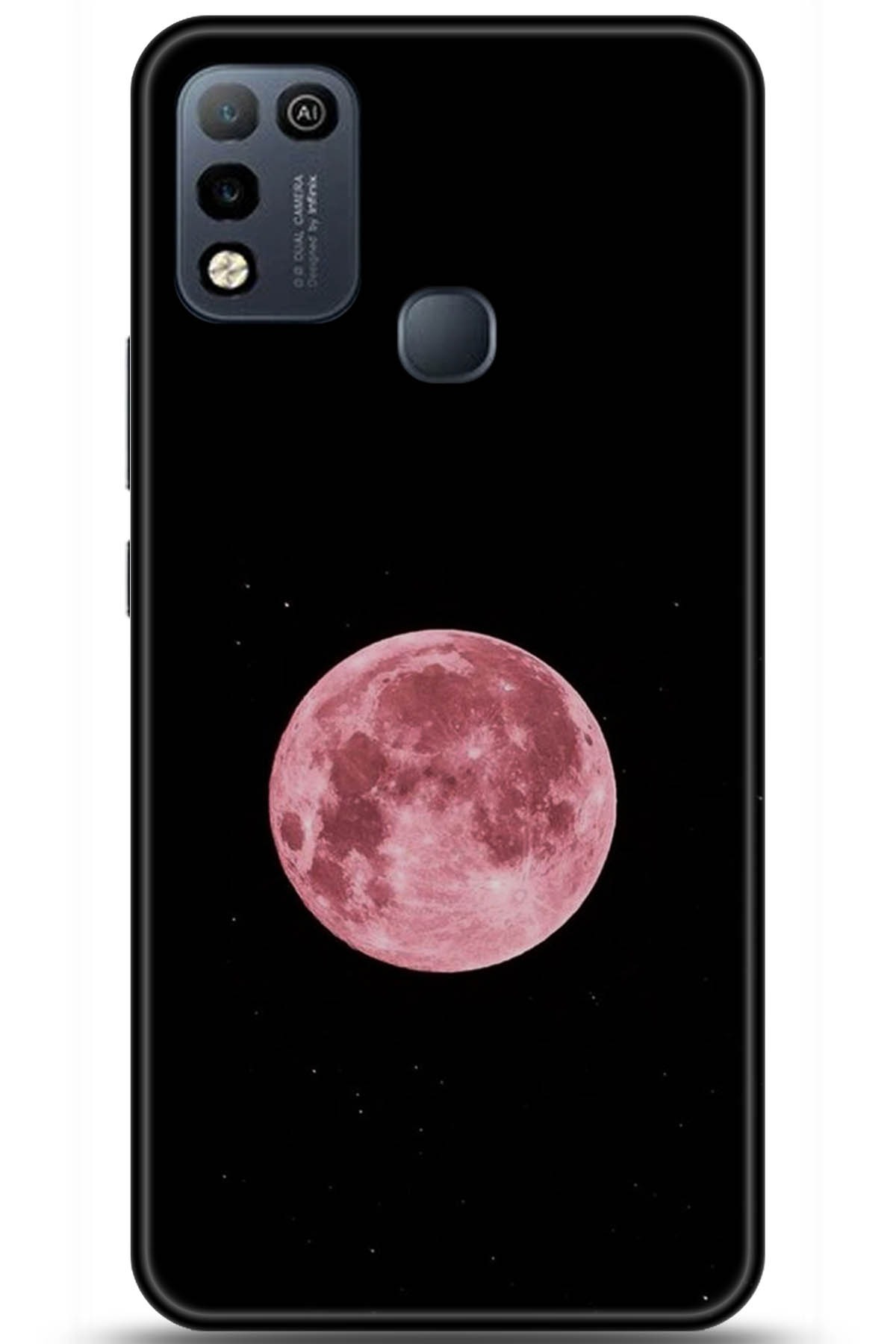 iNfinix Hot 10 Play Uyumlu Kılıf HD Baskılı Kılıf - Followed Institution 5932