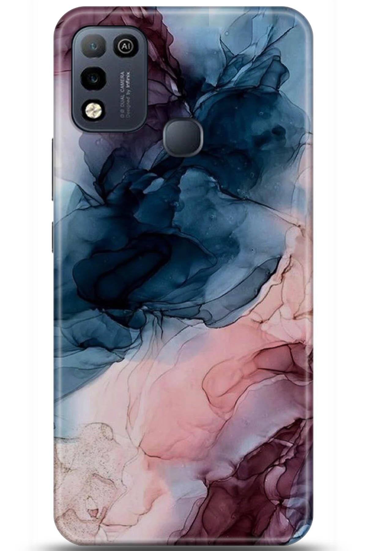 iNfinix Hot 10 Play Uyumlu Kılıf HD Baskılı Kılıf - Followed Institution 5985