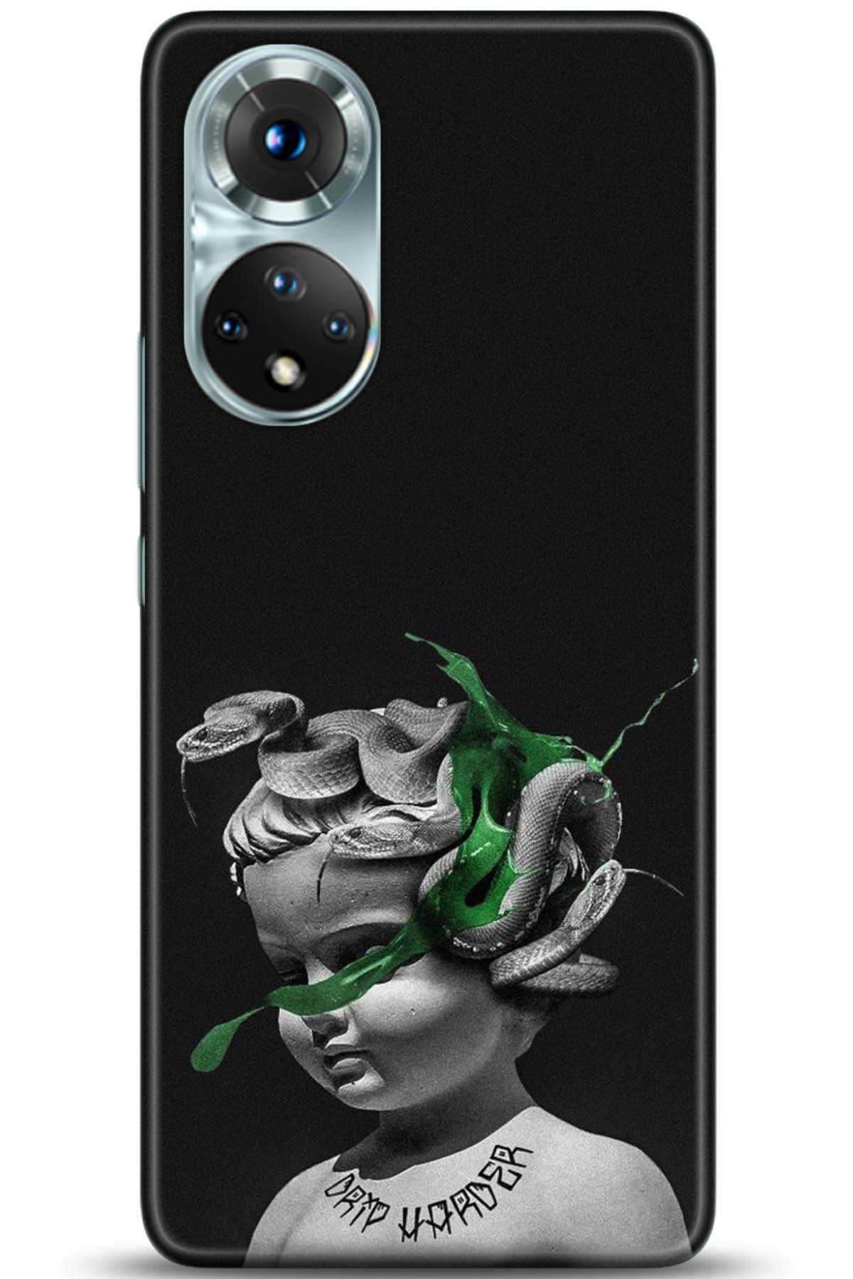 Honor 50 Kılıf HD Baskılı Kılıf - Followed Institution 5077