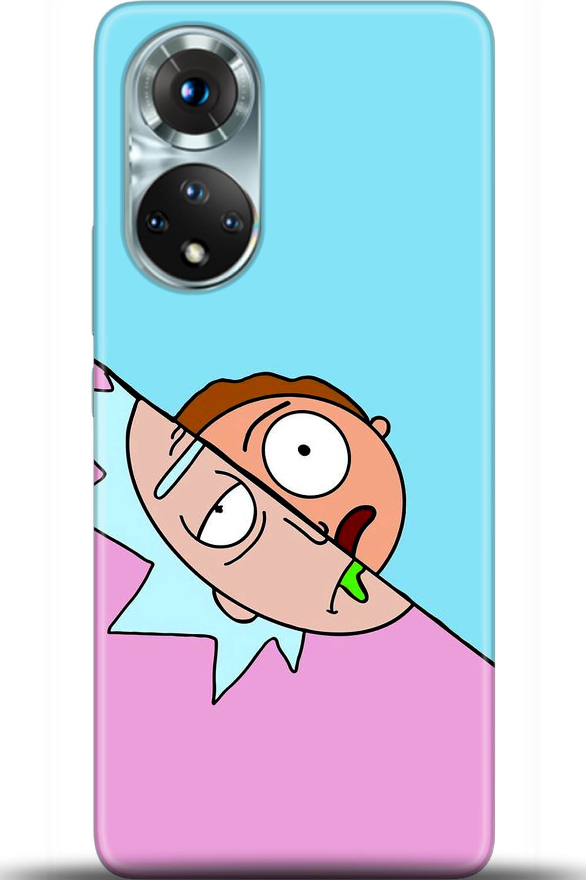 Honor 50 Kılıf HD Baskılı Kılıf - Followed Institution 5437