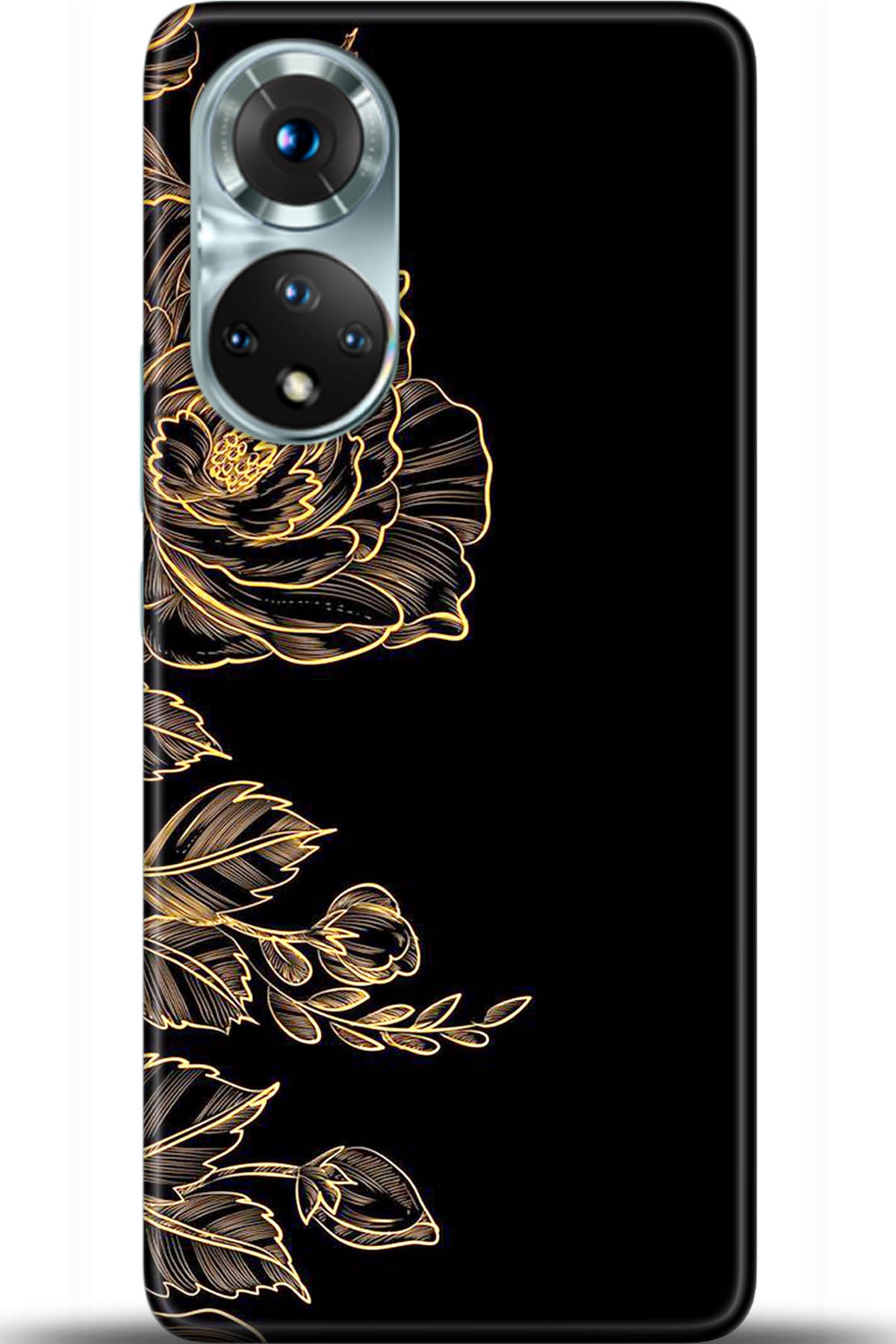 Honor 50 Kılıf HD Baskılı Kılıf - Followed Institution 5482