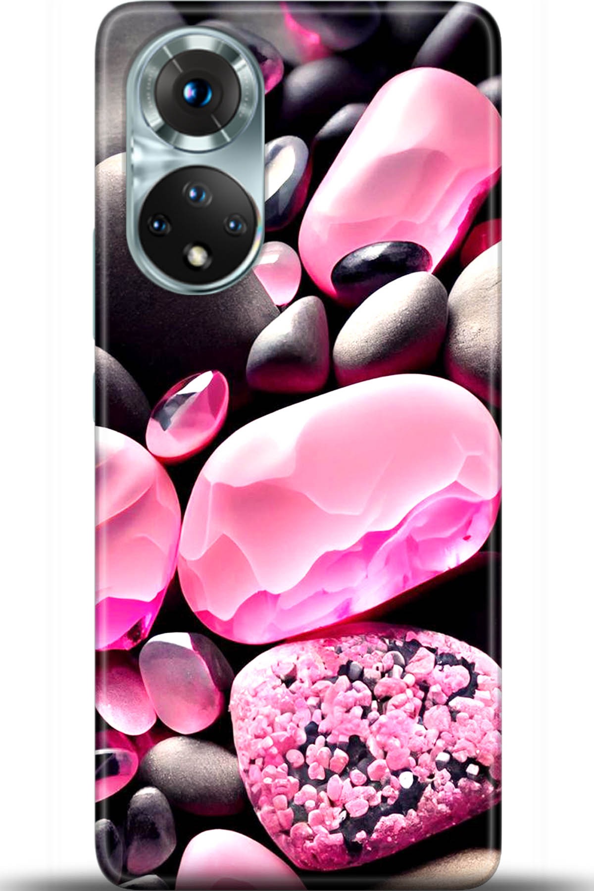 Honor 50 Kılıf HD Baskılı Kılıf - Followed Institution 5529