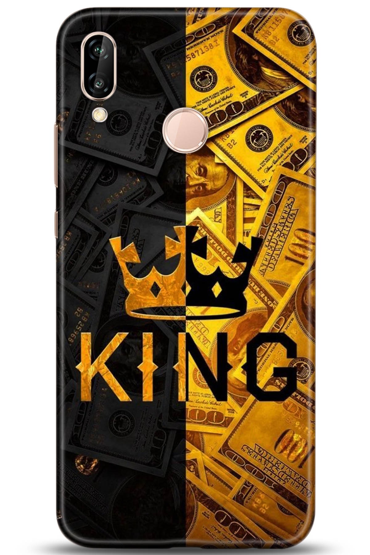 Huawei P20 Lite Uyumlu Kılıf HD Baskılı Kılıf - Followed Institution 5223