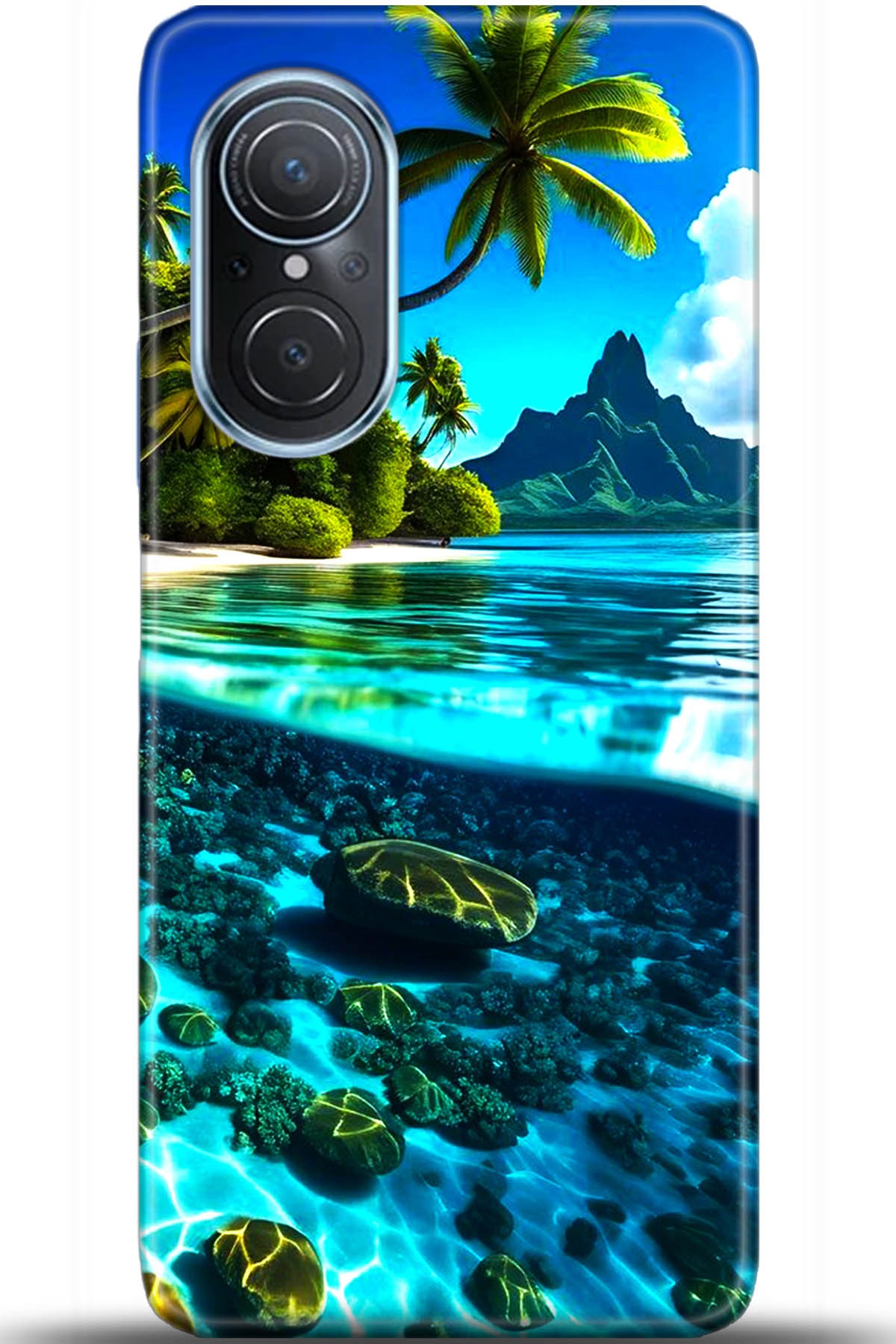 Huawei Nova 9 Uyumlu Kılıf HD Baskılı Kılıf - Followed Institution 5491