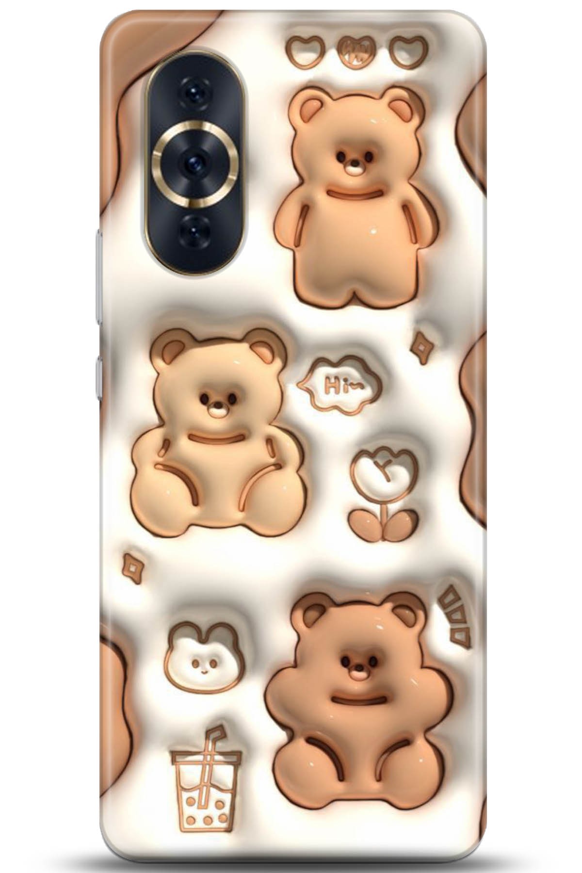 Huawei Nova 10 Pro Uyumlu Kılıf HD Baskılı Kılıf - Followed Institution 5047