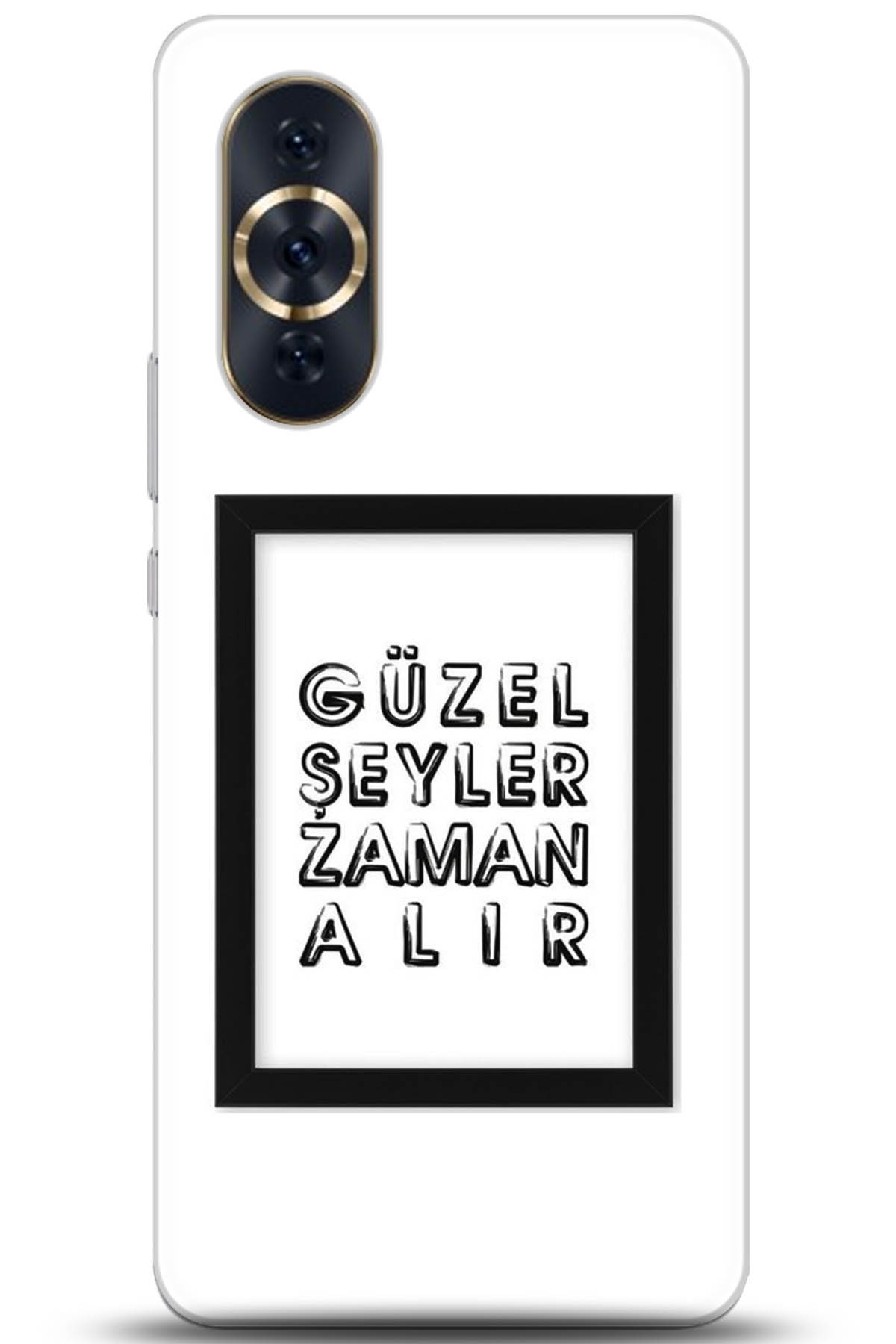 Huawei Nova 10 Pro Uyumlu Kılıf HD Baskılı Kılıf - Followed Institution 5307