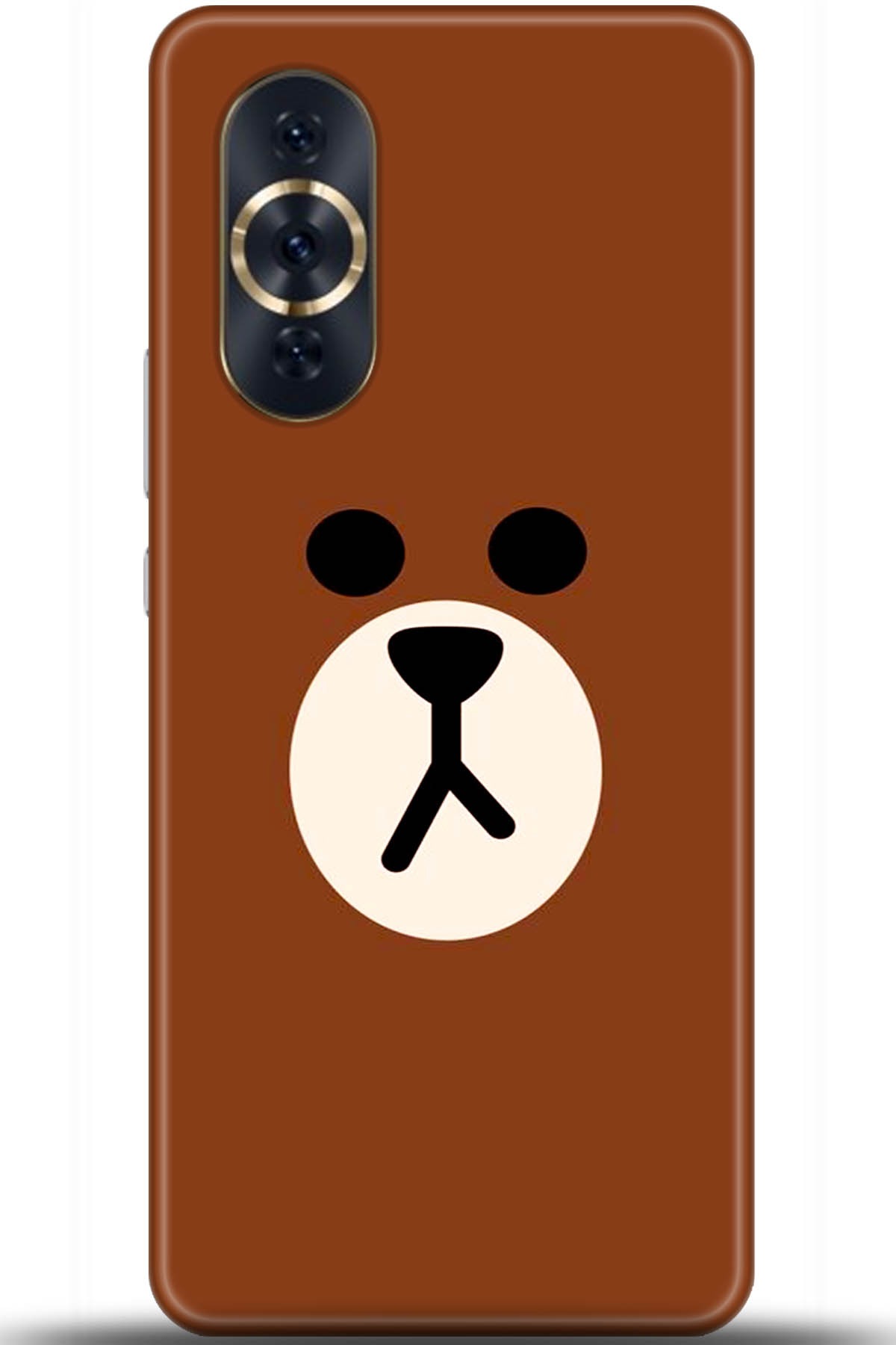 Huawei Nova 10 Pro Uyumlu Kılıf HD Baskılı Kılıf - Followed Institution 5430