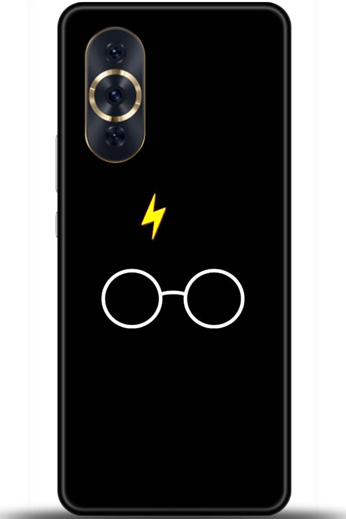 Huawei Nova 10 Pro Uyumlu Kılıf HD Baskılı Kılıf - Followed Institution 5550