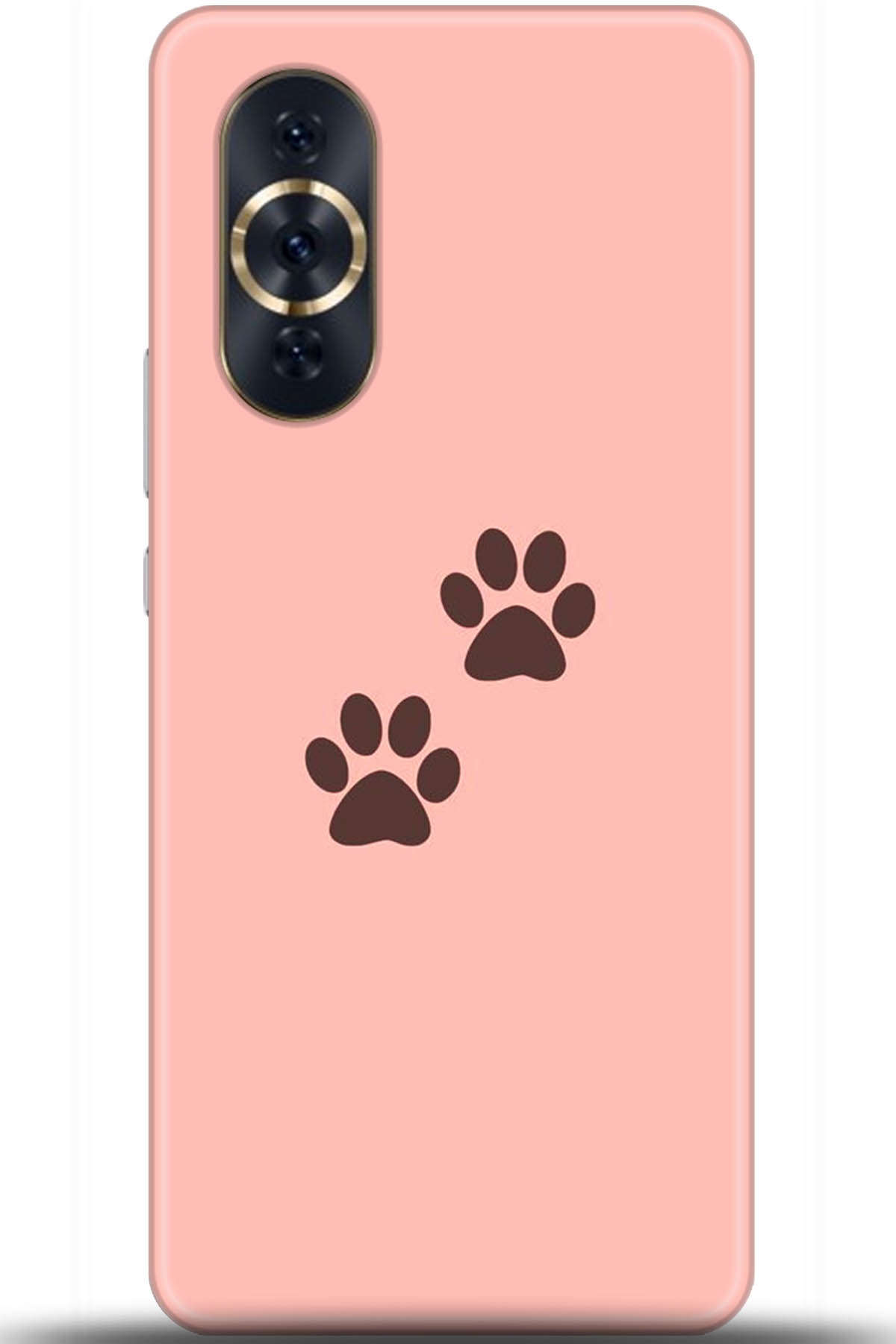 Huawei Nova 10 Pro Uyumlu Kılıf HD Baskılı Kılıf - Followed Institution 5615