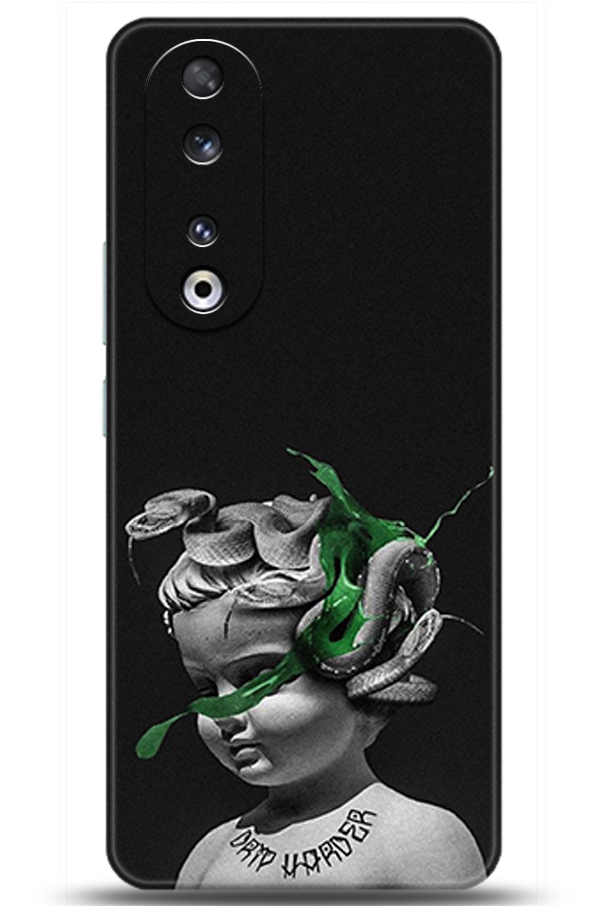 Honor 90 Uyumlu Kılıf HD Baskılı Kılıf - Followed Institution 5077