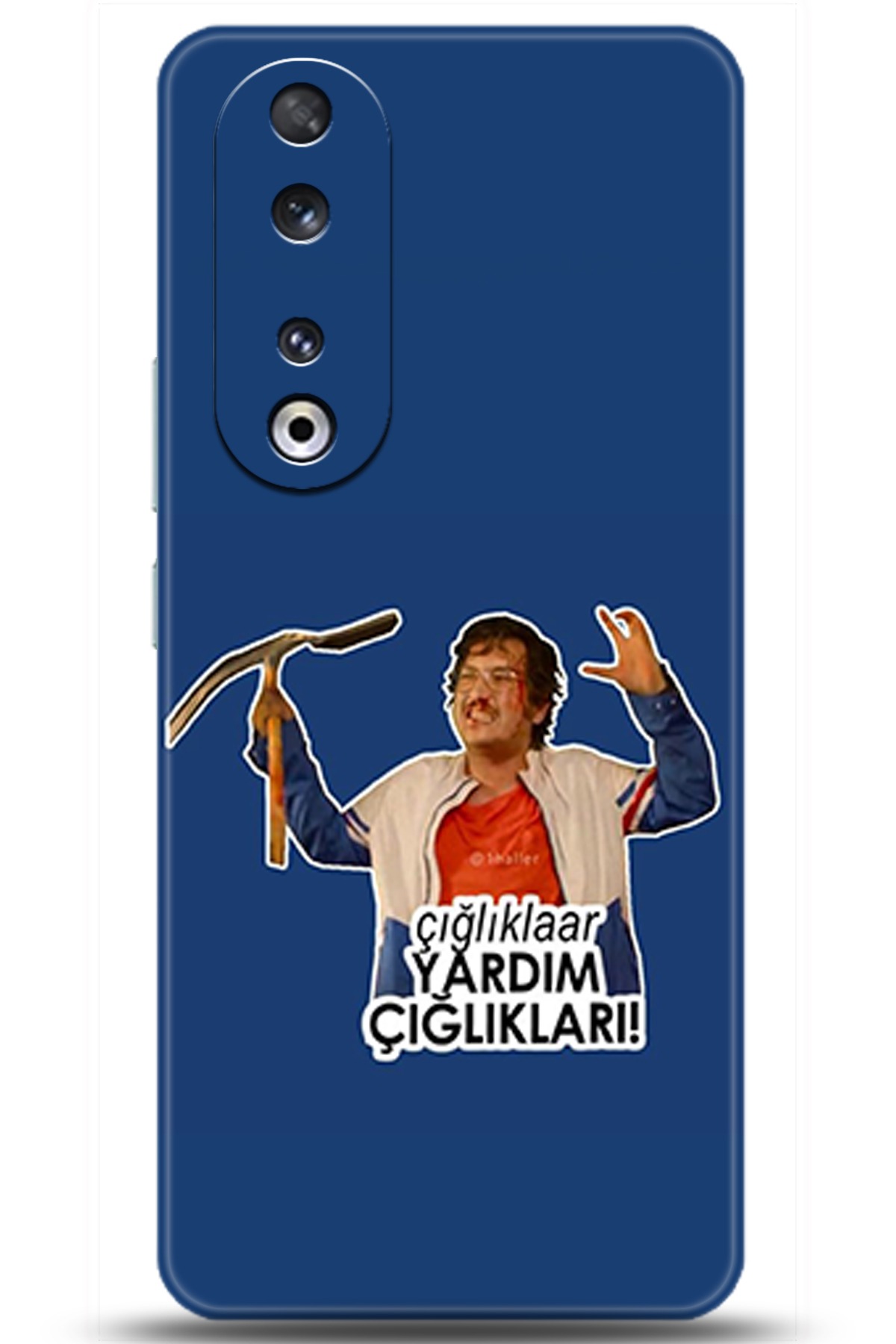 Honor 90 Uyumlu Kılıf HD Baskılı Kılıf - Followed Institution 5157