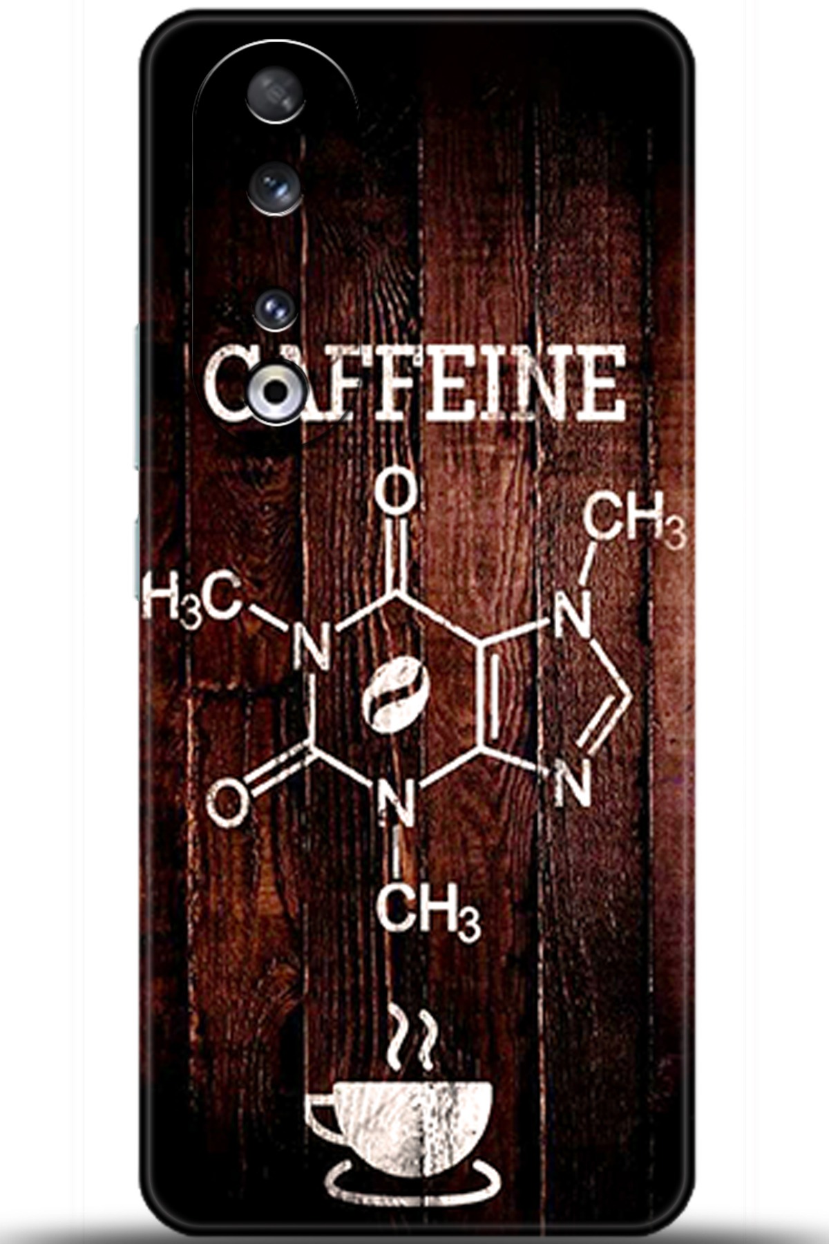 Honor 90 Uyumlu Kılıf HD Baskılı Kılıf - Followed Institution 5501